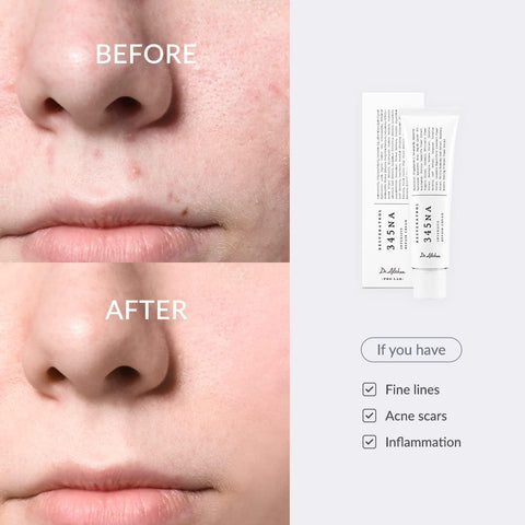 Dr. Althea 345 Relief Cream 50ml